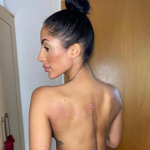 chanelle's skin