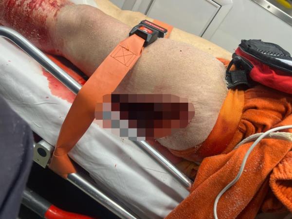 Koltunyuk's injury.