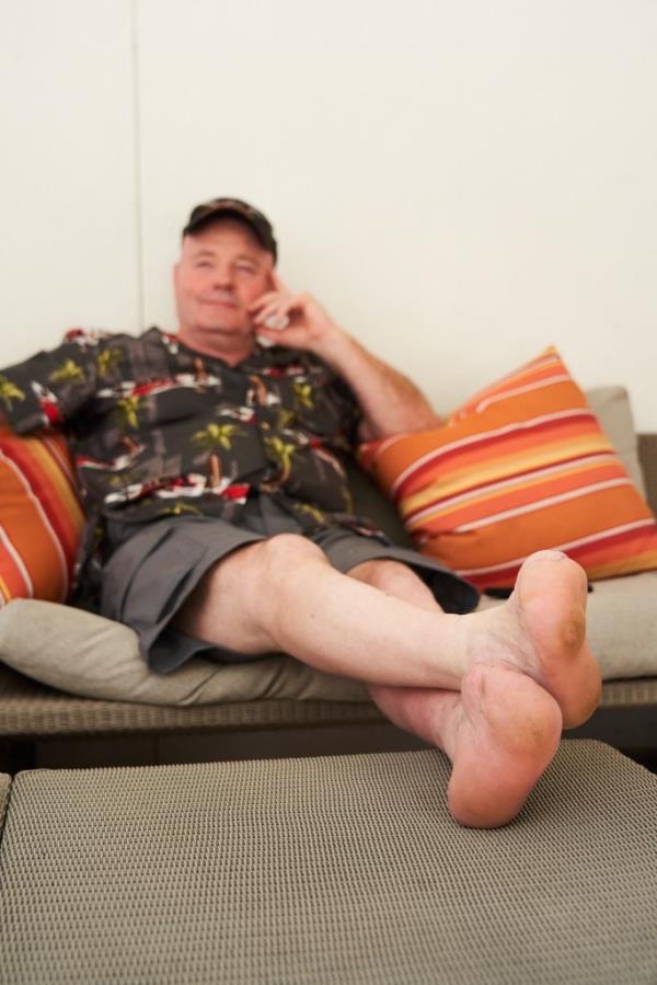 John Bobbitt's amputated feet 