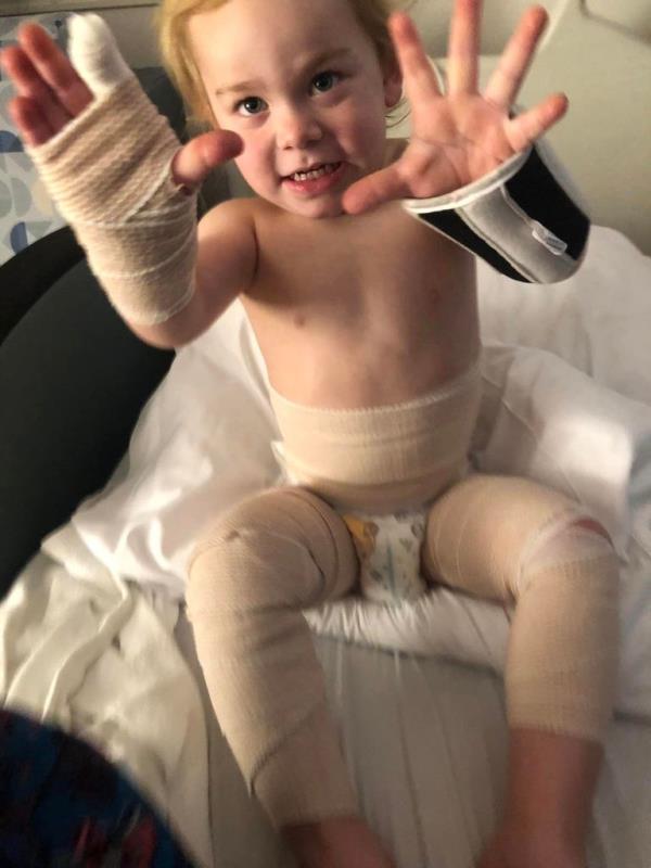Finny shows his hands