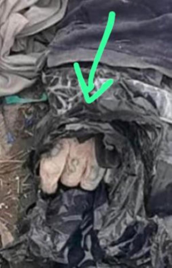 Algaba's dismembered hand.