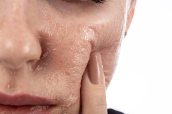 Skincare experts warn that poor air quality can damage skin cells, break down collagen, and spur premature skin aging.