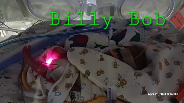 The triplets’ father, Eric Mayeda, introduced the three boys as Burt Isao Leonard-Mayeda, Kikutaro Alan Leonard-Mayeda and Billy Bob Leonard-Mayeda on social media.