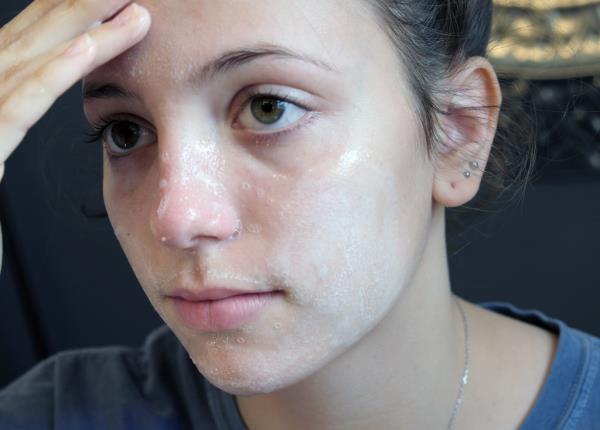 A new analysis has o<em></em>nce again found that dozens of popular acne creams and cleansers co<em></em>ntain 