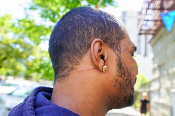 slashing victim scar