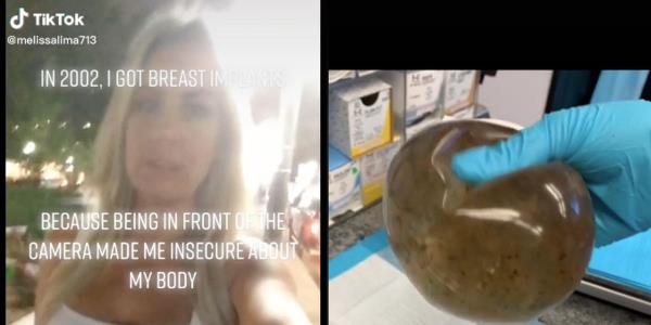 一名妇女在患了10年不明疾病后，在乳房植入物中发现了霉菌