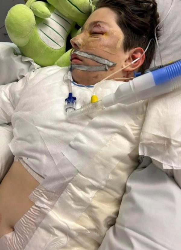 Blaine in a coma after escaping a blaze